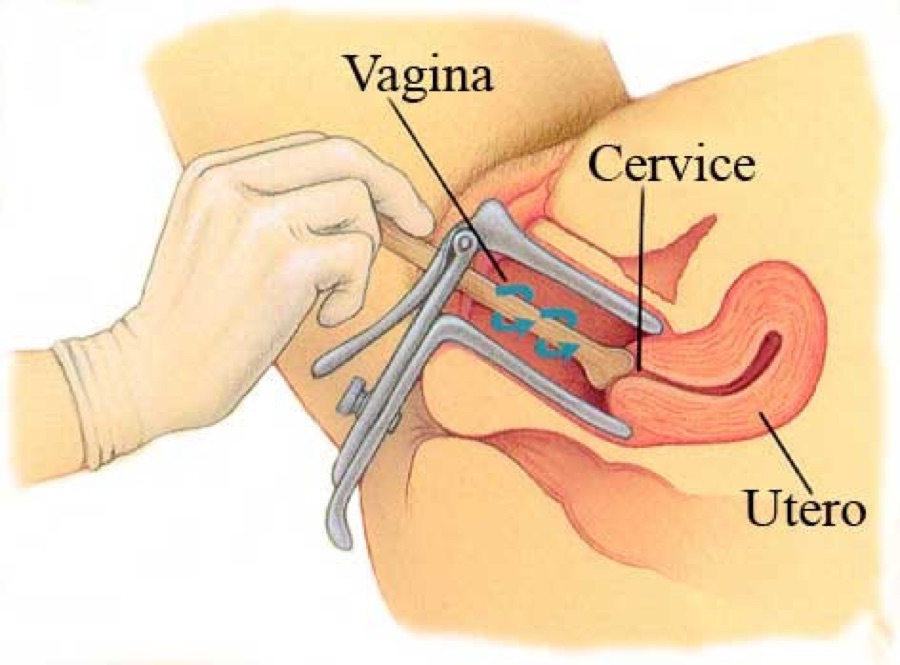 Pap test